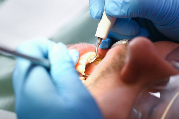 Best Pediatric Emergency Dentist in Hahnville, LA